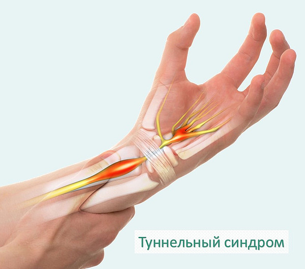 ���������� �������_. 