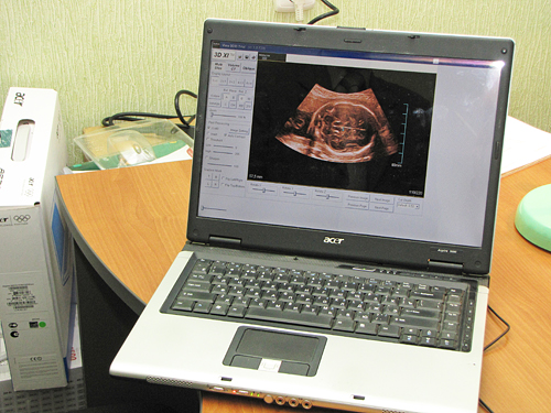 . �����������, ���������� �� �������� ���, ������������� ���������� �� ������� ��������� �����, ��� �� ����� ����������� � ������� ����������� ���������.