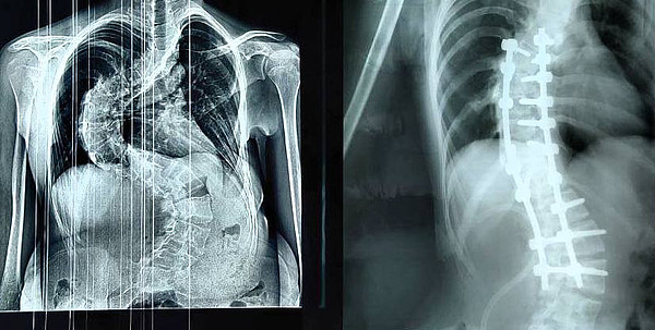 �������_4 ��. 